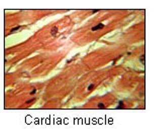 The picture shows a group of muscle cells in the heart. all of these muscle cells beat in unison to