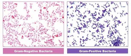 Is the gram stain a useful tool for understanding the phylogeny of eubacteria?  explain why or why n