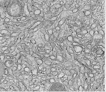 What causes rough endoplasmic reticulum to look “rough” under a microscope?   a rough er has lots of
