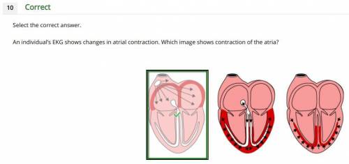 Which image shows the contraction of the atria