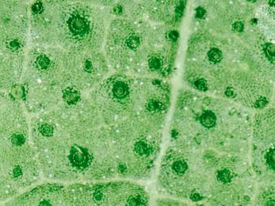the image shows a magnified view of a leaf's surface with the stomata visible. what’s the signifi