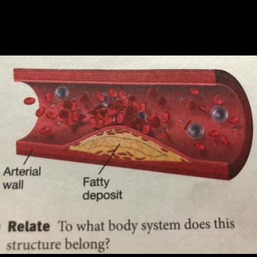 What body system does this structure belong?