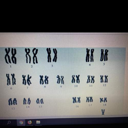 Which notation correctly describes the patient with this karyotype?  100 points