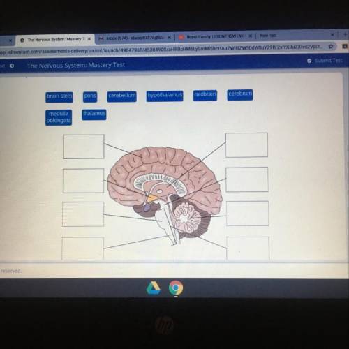 Drag each label to the correct location on the diagram. Label the parts of the brain. brain stem pon