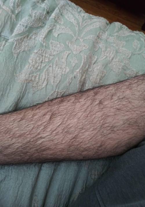Is it normal to have hairy legs at 15 years old as a boy and should I do anything? plz answer I will