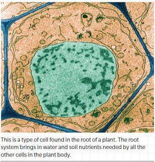 Which of the following statements are true about the cell in the image? Select all that apply. * 1)