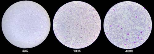 How does this image compare to the white blood cells you saw using Stella’s compound microscope? Wh