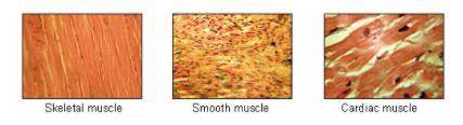 Which statement BEST summarizes why these human muscle cell types look different?

A) The muscle c