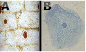 Refer to the microscopic photos below.

Which cell is an onion cell and which is a cheek cell, and