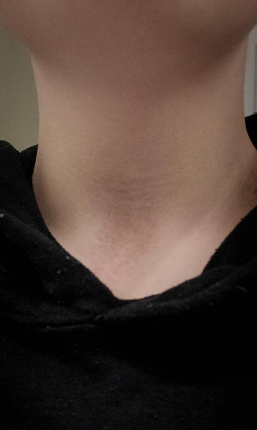 can someone tell me what this is, its on my neck, its like a random splotch. it doesn't itch or any