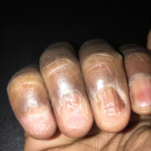 Can someone help me with tips on how to grow your nails.