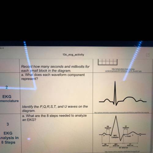 A. What does each waveform component

represent?
Identify the P,Q,R, S, T, and U waves on the
diag