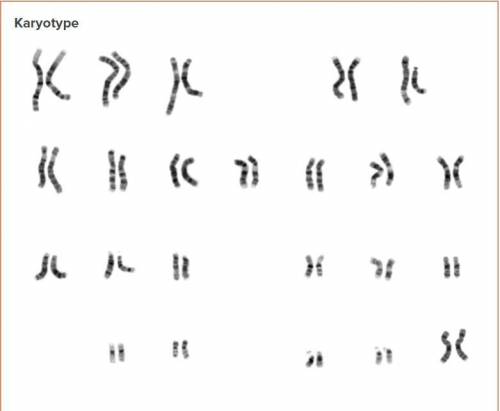 Which pair of chromosomes have noticeably different lengths?