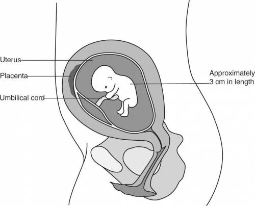 The following image shows one stage of a pregnancy.

Which stage of pregnancy is it?
Group of answ