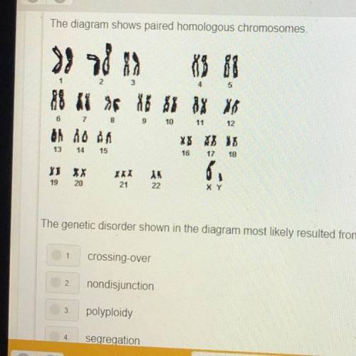 The diagram shows paired homologous chromosomes.

The genetic disorder shown in the diagram most l