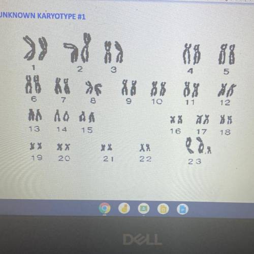 Look at chromosome pair #23. Write the sex chromosomes here. Answer

Which chromosome(s) are abnor