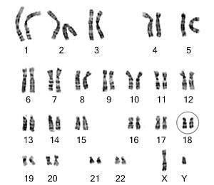 How are karyotypes made?
