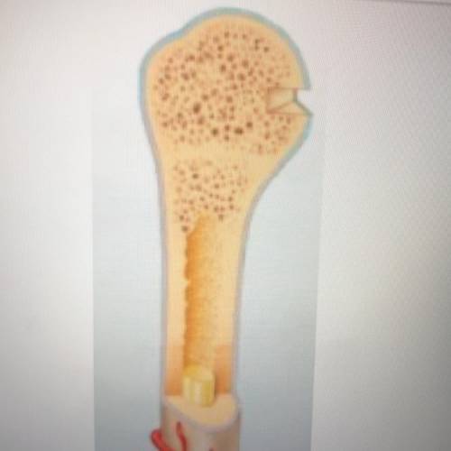 Label the marrow, spongy bone, and cortical bone on this bone image.