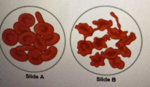 HELP WILL MARK BRAINLIST

What would explain why the cells in Slide B appeared different than no