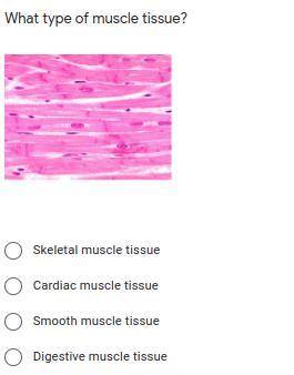 What type of muscle tissue is this