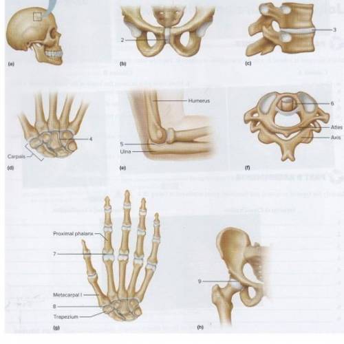 Figure 18.2 identify the types of joints that are numbered in these illustrations?