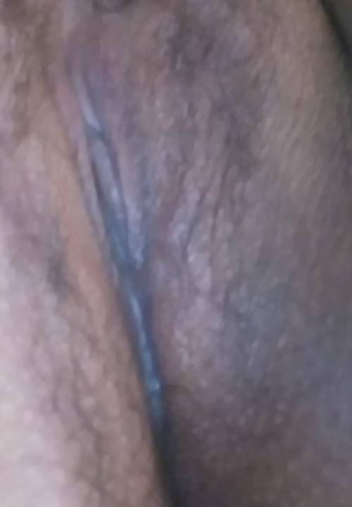Hii Please help me with the details of a vag