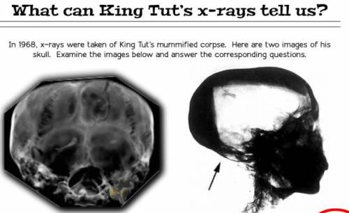 The x-ray on the right is pointing out an area on the back and bottom of Tut's skull. The large whi