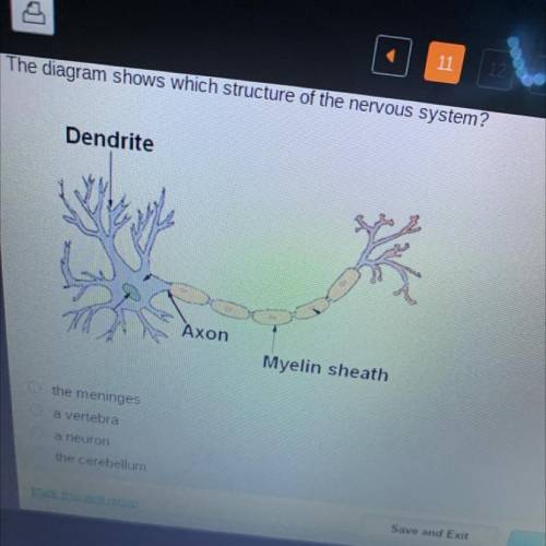 The diagram shows which structure of the nervous system?

Dendrite
Axon
Myelin sheath
the meninges
