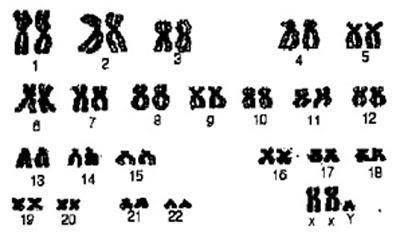 2. Look at the karyotype below, and note anything unusual. Find out what this unusual genotype mean