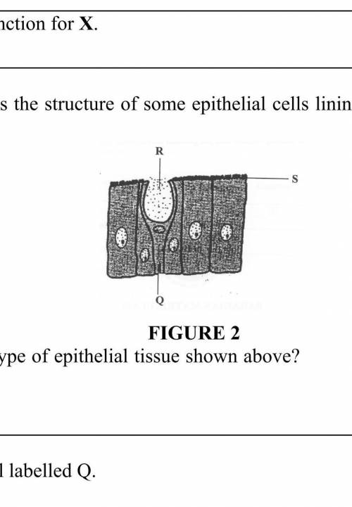 FIGURE 2 shows the structure of some epithelial cells lining the mammalian small intestine. FIGURE