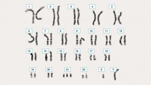 Are there any chromosomal abnormalities?
