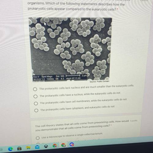 5 points

Ima uses a microscope to study different prokaryotic and eukaryotic
organisms. Which of