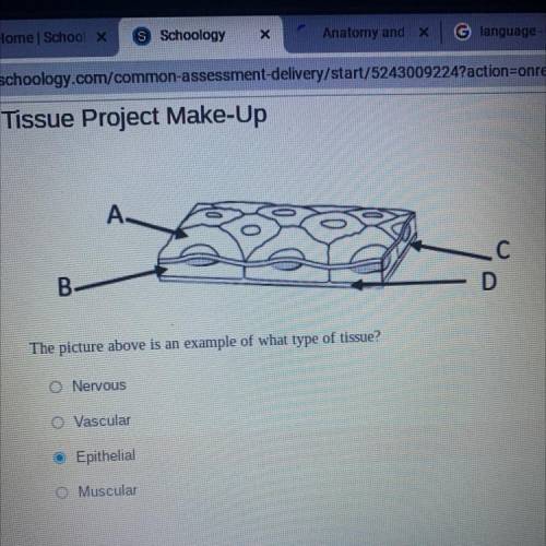 The picture above is an example of what type of tissue?