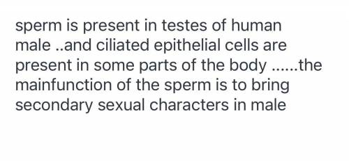 What are the similarities between a sperm cell and a ciliated epithelial cell