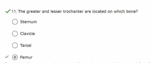 The greater and lesser trochanter are located on which bone?
