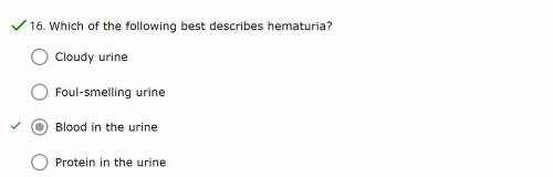 Which of the following best describes hematuria?
*Blood in the urine