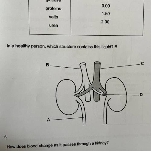 In a healthy person, which structure contains this liquid? B
PLEASE HELPPPPP